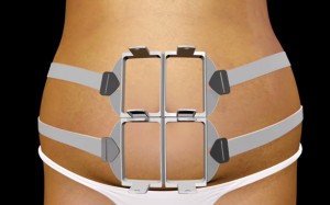 sculpsure_cristinaalvarez_01042016_estetic